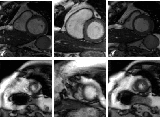 Figure 1 for Automatic Right Ventricle Segmentation using Multi-Label Fusion in Cardiac MRI