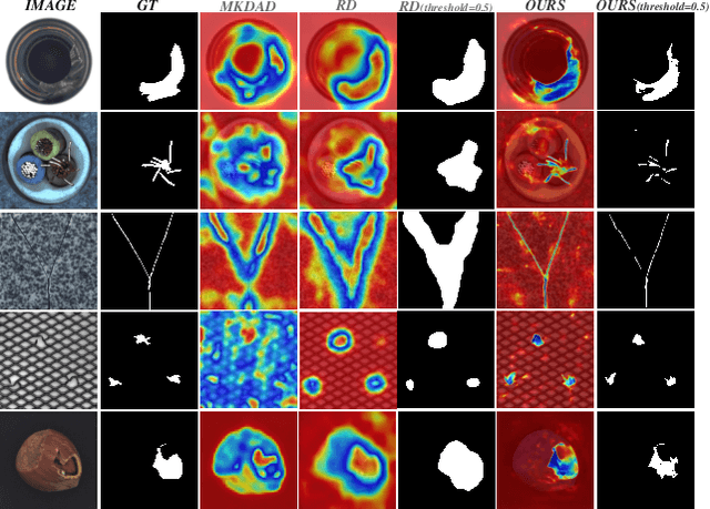 Figure 3 for Asymmetric Distillation Post-Segmentation Method for Image Anomaly Detection