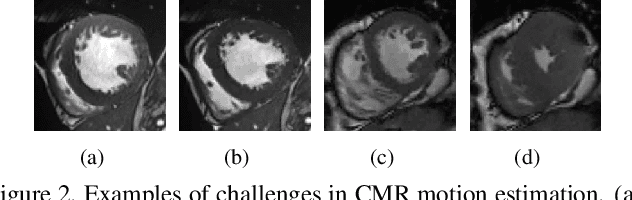 Figure 3 for FOAL: Fast Online Adaptive Learning for Cardiac Motion Estimation