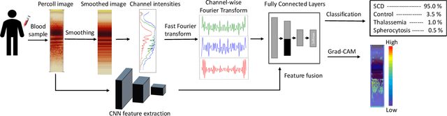 Figure 1 for Fourier Transform of Percoll Gradients Boosts CNN Classification of Hereditary Hemolytic Anemias