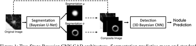 Figure 1 for Propagating Uncertainty in Multi-Stage Bayesian Convolutional Neural Networks with Application to Pulmonary Nodule Detection
