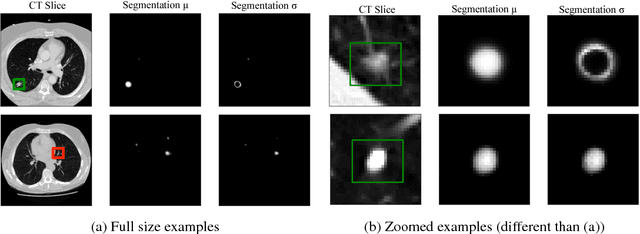 Figure 3 for Propagating Uncertainty in Multi-Stage Bayesian Convolutional Neural Networks with Application to Pulmonary Nodule Detection