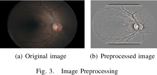 Figure 3 for Multi-Cell Multi-Task Convolutional Neural Networks for Diabetic Retinopathy Grading