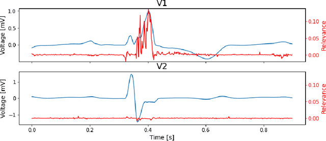 Figure 3 for InterpretTime: a new approach for the systematic evaluation of neural-network interpretability in time series classification