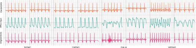 Figure 4 for CardioGAN: Attentive Generative Adversarial Network with Dual Discriminators for Synthesis of ECG from PPG