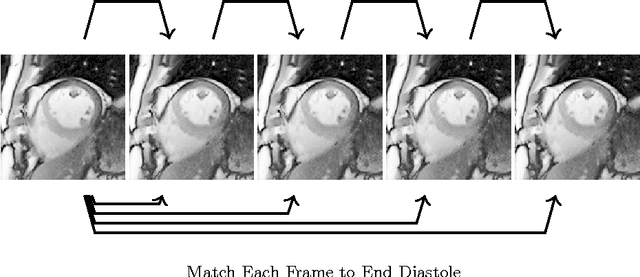Figure 1 for Feature Tracking Cardiac Magnetic Resonance via Deep Learning and Spline Optimization
