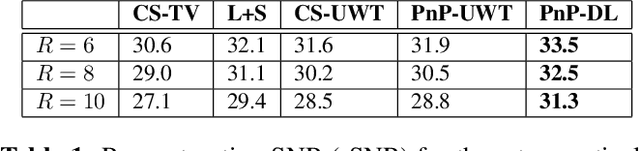 Figure 2 for Free-breathing Cardiovascular MRI Using a Plug-and-Play Method with Learned Denoiser