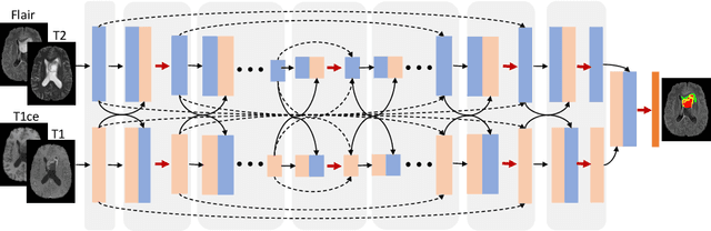 Figure 1 for Modality-Pairing Learning for Brain Tumor Segmentation