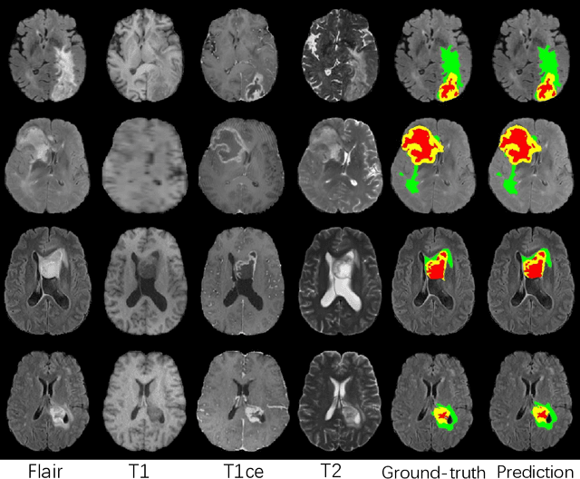 Figure 3 for Modality-Pairing Learning for Brain Tumor Segmentation