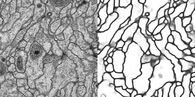 Figure 4 for Fast Image Scanning with Deep Max-Pooling Convolutional Neural Networks
