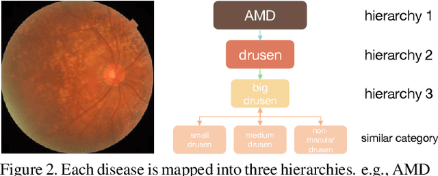 Figure 3 for Long-Tailed Multi-Label Retinal Diseases Recognition Using Hierarchical Information and Hybrid Knowledge Distillation