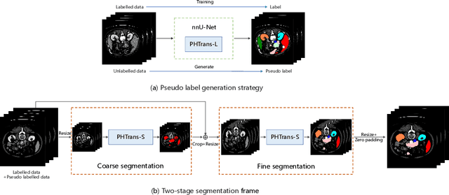 Figure 1 for Combining Hybrid Architecture and Pseudo-label for Semi-supervised Abdominal Organ Segmentation