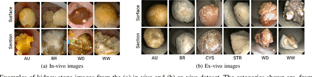 Figure 2 for On the generalization capabilities of FSL methods through domain adaptation: a case study in endoscopic kidney stone image classification