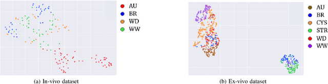 Figure 3 for On the generalization capabilities of FSL methods through domain adaptation: a case study in endoscopic kidney stone image classification