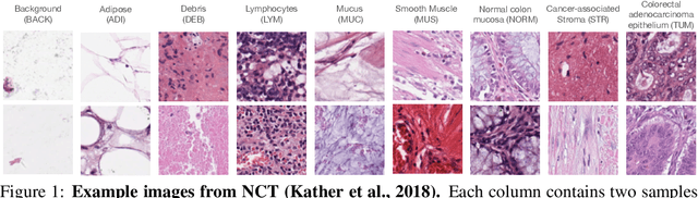 Figure 1 for Towards better understanding and better generalization of few-shot classification in histology images with contrastive learning