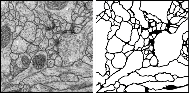 Figure 1 for FusionNet: A deep fully residual convolutional neural network for image segmentation in connectomics