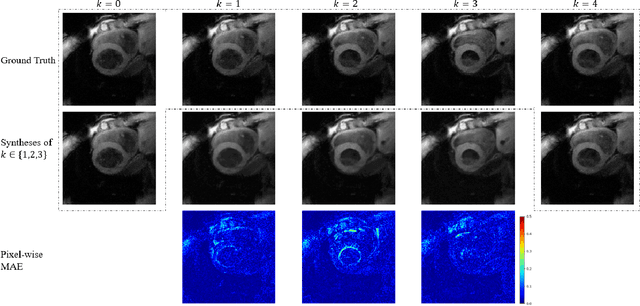 Figure 2 for Synthetic Velocity Mapping Cardiac MRI Coupled with Automated Left Ventricle Segmentation