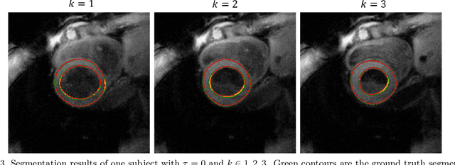 Figure 4 for Synthetic Velocity Mapping Cardiac MRI Coupled with Automated Left Ventricle Segmentation