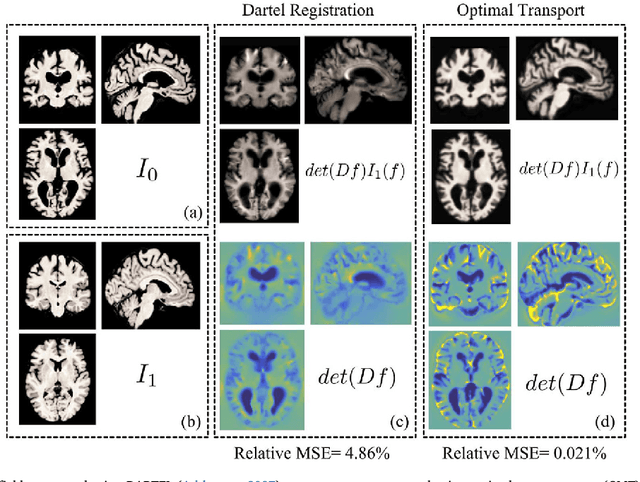 Figure 3 for Discovery and visualization of structural biomarkers from MRI using transport-based morphometry