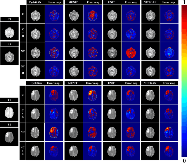 Figure 3 for Breaking the Dilemma of Medical Image-to-image Translation