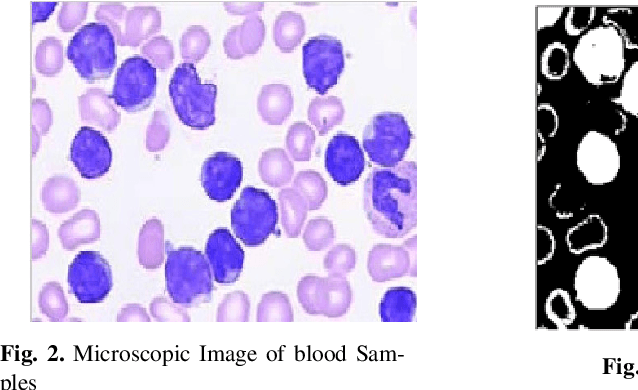 Figure 4 for Automated Detection of Acute Leukemia using K-mean Clustering Algorithm