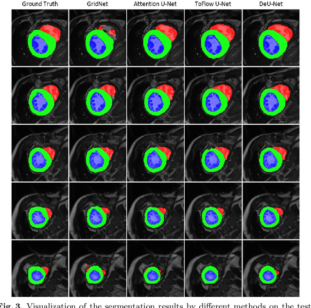 Figure 4 for DeU-Net: Deformable U-Net for 3D Cardiac MRI Video Segmentation