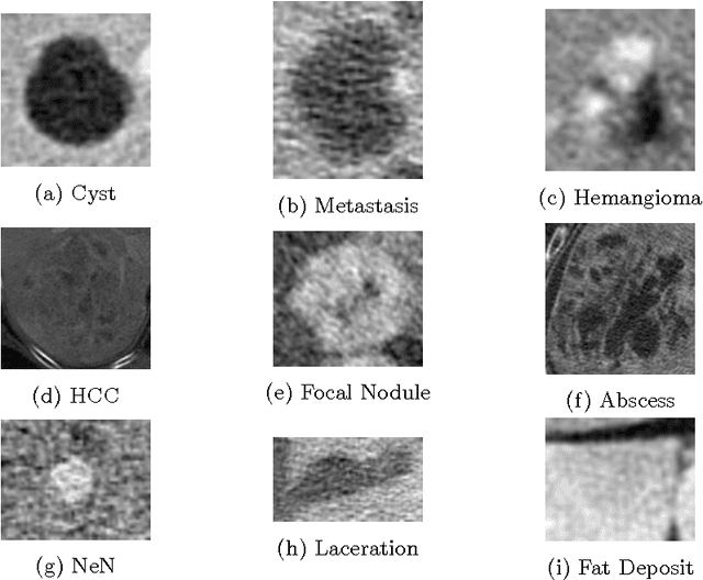 Figure 2 for Classification of Hepatic Lesions using the Matching Metric