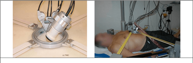 Figure 2 for TER: A Robot for Remote Ultrasonic Examination: Experimental Evaluations