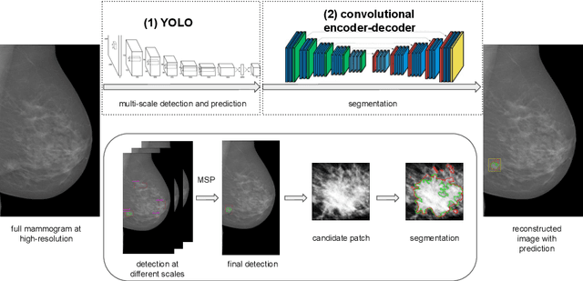 Figure 1 for Two-stage breast mass detection and segmentation system towards automated high-resolution full mammogram analysis