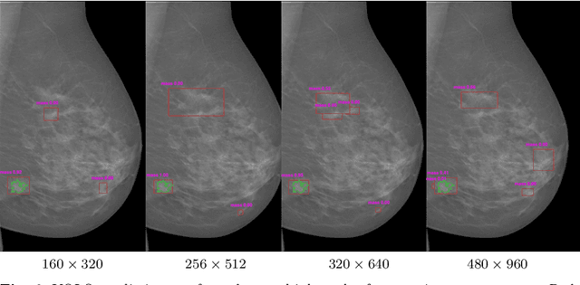 Figure 2 for Two-stage breast mass detection and segmentation system towards automated high-resolution full mammogram analysis