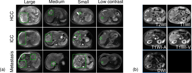 Figure 1 for Fully-Automated Liver Tumor Localization and Characterization from Multi-Phase MR Volumes Using Key-Slice ROI Parsing: A Physician-Inspired Approach