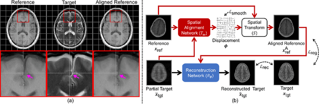 Figure 1 for Multi-Modal MRI Reconstruction with Spatial Alignment Network