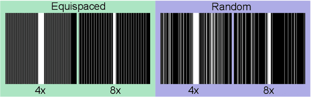 Figure 3 for Multi-Modal MRI Reconstruction Assisted with Spatial Alignment Network