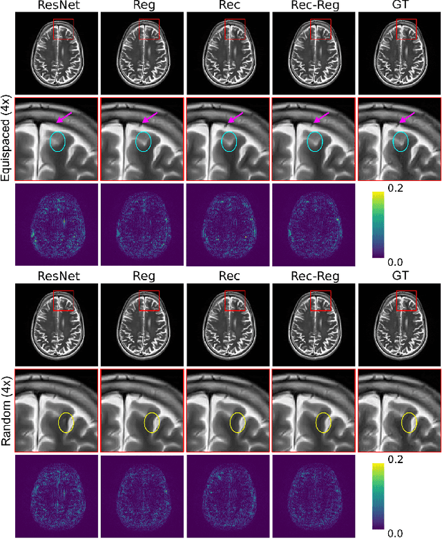 Figure 4 for Multi-Modal MRI Reconstruction with Spatial Alignment Network