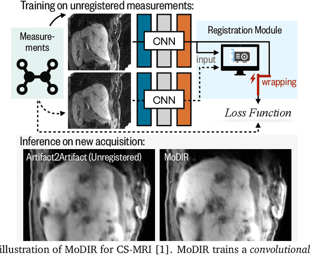 Figure 1 for MoDIR: Motion-Compensated Training for Deep Image Reconstruction without Ground Truth