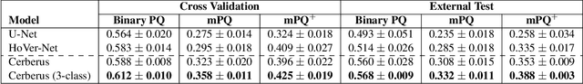 Figure 4 for One Model is All You Need: Multi-Task Learning Enables Simultaneous Histology Image Segmentation and Classification