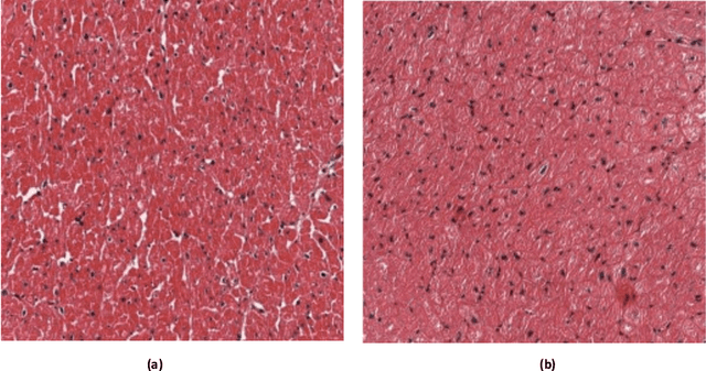 Figure 4 for Self-attention based BiLSTM-CNN classifier for the prediction of ischemic and non-ischemic cardiomyopathy