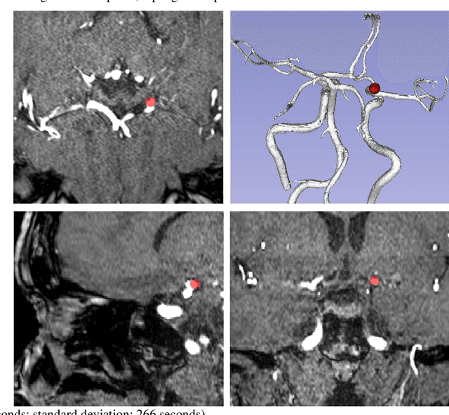 Figure 2 for Weak labels and anatomical knowledge: making deep learning practical for intracranial aneurysm detection in TOF-MRA