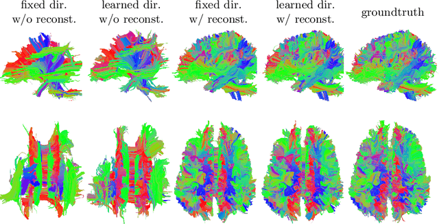 Figure 4 for Towards learned optimal q-space sampling in diffusion MRI