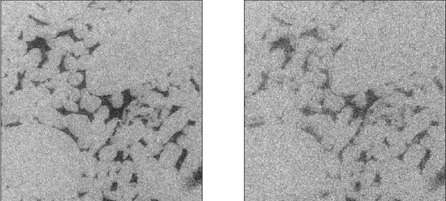 Figure 3 for Deep-Learning Driven Noise Reduction for Reduced Flux Computed Tomography