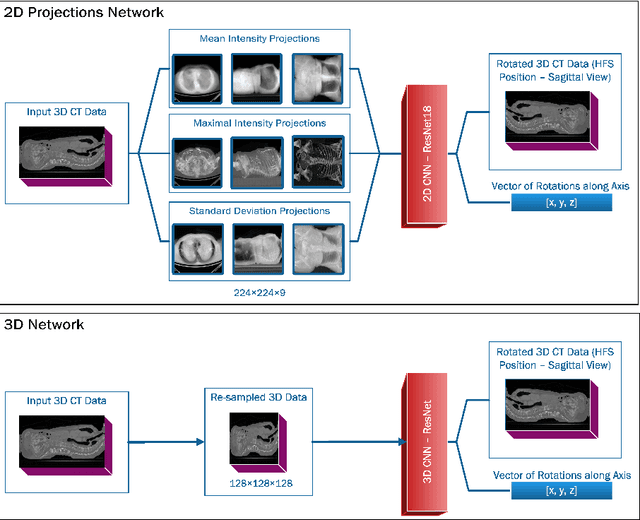 Figure 1 for A Tool for Automatic Estimation of Patient Position in Spinal CT Data