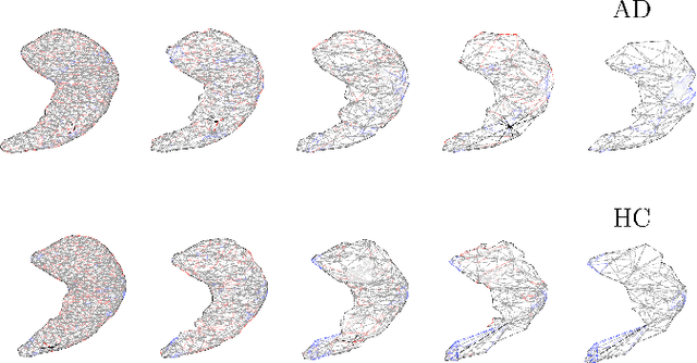 Figure 1 for Geometric Deep Learning on Anatomical Meshes for the Prediction of Alzheimer's Disease