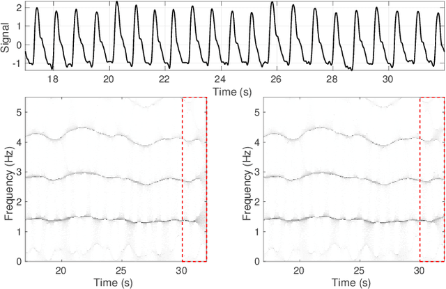 Figure 1 for An Efficient Forecasting Approach to Reduce Boundary Effects in Real-Time Time-Frequency Analysis