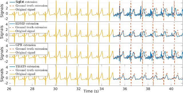 Figure 2 for An Efficient Forecasting Approach to Reduce Boundary Effects in Real-Time Time-Frequency Analysis