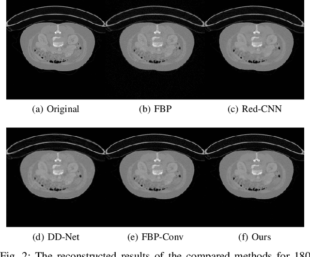 Figure 2 for A deep network for sinogram and CT image reconstruction