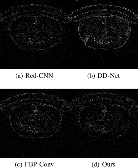 Figure 3 for A deep network for sinogram and CT image reconstruction