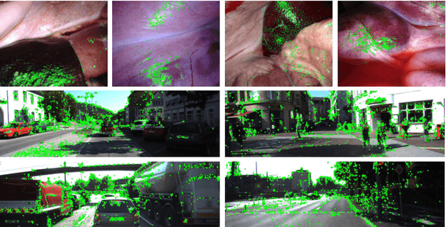 Figure 1 for Self-Supervised Monocular Depth and Ego-Motion Estimation in Endoscopy: Appearance Flow to the Rescue