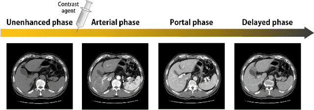 Figure 1 for CycleMorph: Cycle Consistent Unsupervised Deformable Image Registration