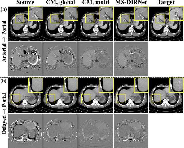 Figure 3 for CycleMorph: Cycle Consistent Unsupervised Deformable Image Registration