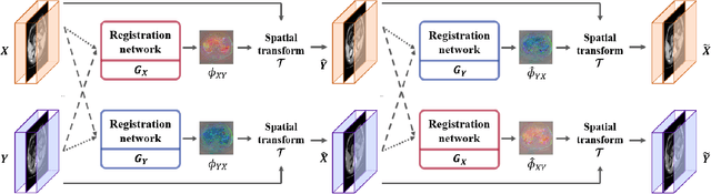 Figure 4 for CycleMorph: Cycle Consistent Unsupervised Deformable Image Registration